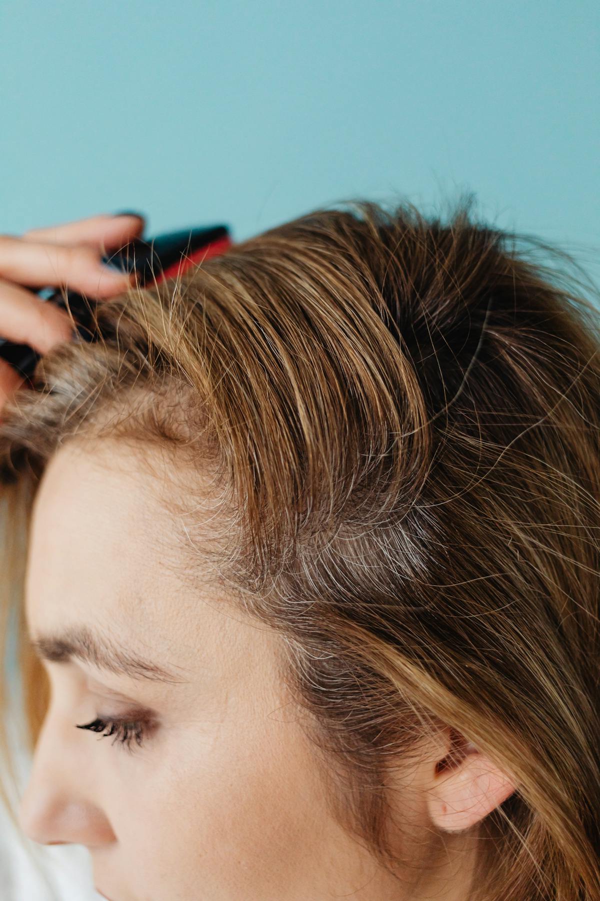 A sophisticated and radiant woman showcasing the confidence that comes with restored hair density