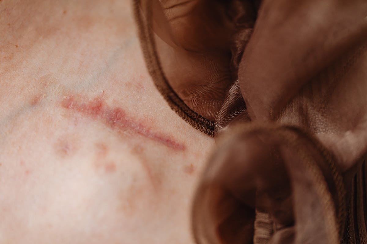 A professional and sterile medical tattooing environment, representing the expert care required for scar camouflage