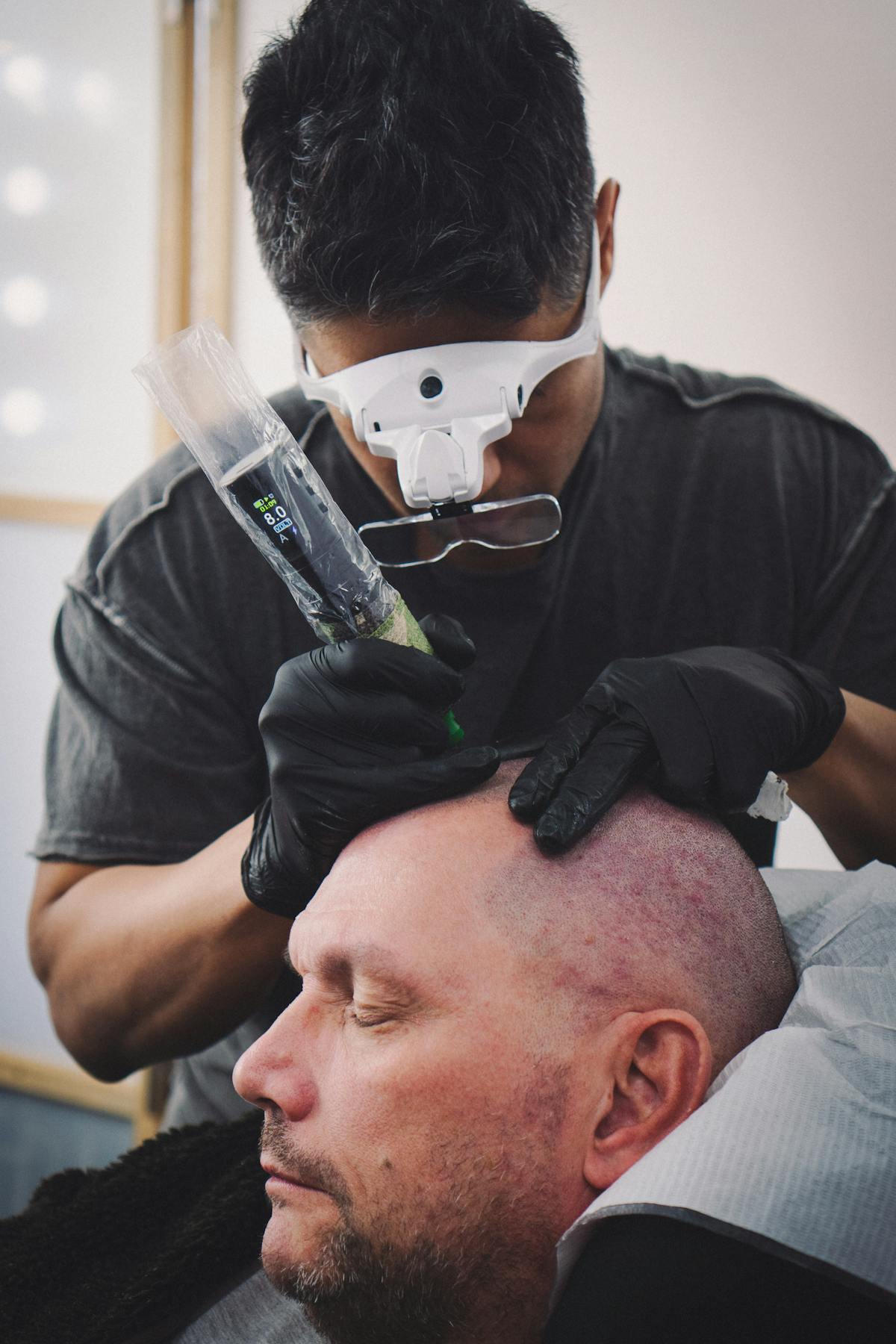 A professional and sterile beauty environment, representing the expert care and precision required for alopecia restoration
